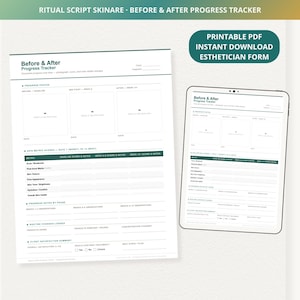 Pode incluir: Um formulário de esteticista em PDF imprimível para rastrear o progresso dos cuidados com a pele. O documento branco apresenta seções para fotos de antes e depois, pontuações métricas da pele e notas. Um tablet exibe o mesmo formulário.