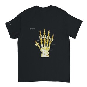 May include: Black t-shirt featuring a skeletal hand wearing championship rings. The graphic includes the text "patient 404 Kobe Bryant". The rings are gold-colored with a detailed design. The shirt is a classic crew neck style.