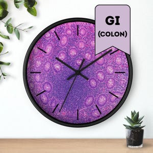 Histology Wall Clock, Pathology Stain Colon Anatomy, Pathologist Gift