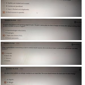 HESI RN Health Assessment Exam Questions and Answers 2025 Update