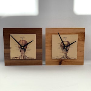 May include: Two wooden clock bases with a skeleton clock face featuring a skull and spine. The clock faces are printed with anatomical illustrations.