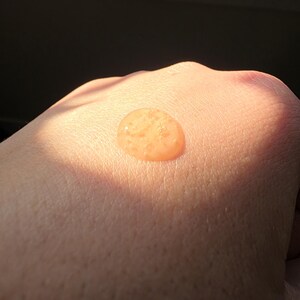 May include: A close-up shot of a hand with a small, round, orange-colored liquid droplet on the skin. The droplet is illuminated by sunlight, creating a bright, warm glow. The skin appears smooth and slightly textured.