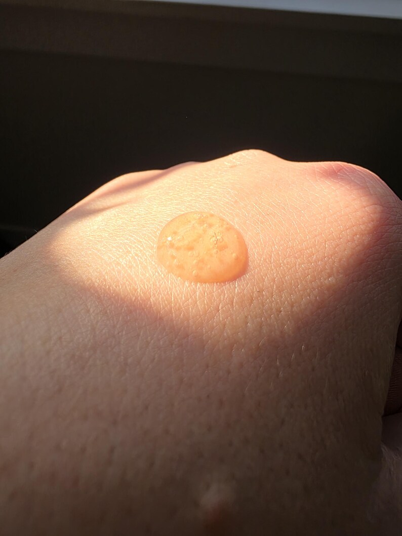 May include: A close-up shot of a hand with a small, round, orange-colored liquid droplet on the skin. The droplet is illuminated by sunlight, creating a bright, warm glow. The skin appears smooth and slightly textured.