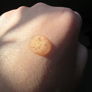 May include: A close-up shot of a hand with a small, round, amber-colored droplet of liquid on the skin. The droplet has a slightly bubbly texture and reflects the light. The skin is light-toned and the background is dark.