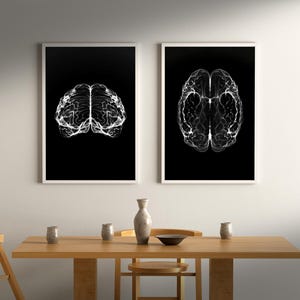 Op de afbeelding: Twee ingelijste kunstprints met witte, gloeiende hersenillustraties tegen een zwarte achtergrond. De prints hangen aan een witte muur boven een houten eettafel met decoratieve items.