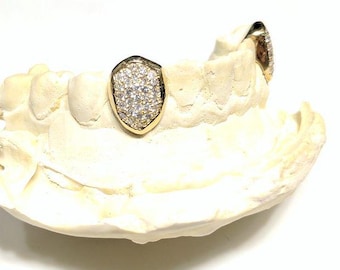 May include: Close-up of a dental mold with two gold-plated tooth caps. Each cap is encrusted with numerous small, clear gemstones, creating a sparkling effect. The caps are set against a white background.