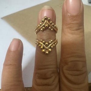 Adjustable Arthritis Ring, Finger Splint, Trigger Finger Rings