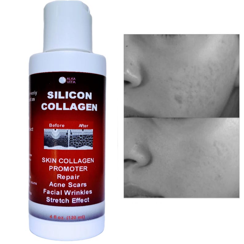May include: A white plastic bottle of Alka Vita Silicon Collagen skin promoter with a red and black label. The label features the text Silicon Collagen, Skin Collagen Promoter, Repair Acne Scars, Facial Wrinkles, Stretch Effect, and 4 fl oz.