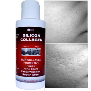 May include: A white plastic bottle of Alka Vita Silicon Collagen skin promoter with a red and white label. The label text reads Silicon Collagen, Skin Collagen Promoter, Repair Acne Scars, Facial Wrinkles, Stretch Effect, and 4 fl oz (120 ml).