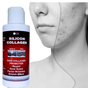 May include: A white plastic bottle of Alka Vita Silicon Collagen skin promoter with a red and white label. The label features the text Silicon Collagen, Skin Collagen Promoter, Repair, Acne Scars, Facial Wrinkles, Stretch Effect, and 4 fl oz (120 ml).