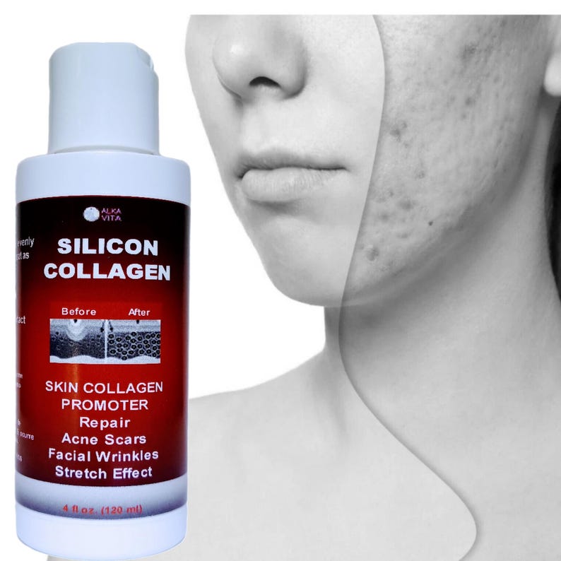 May include: A white plastic bottle of Alka Vita Silicon Collagen skin promoter with a red and white label. The label features the text Silicon Collagen, Skin Collagen Promoter, Repair, Acne Scars, Facial Wrinkles, Stretch Effect, and 4 fl oz (120 ml).