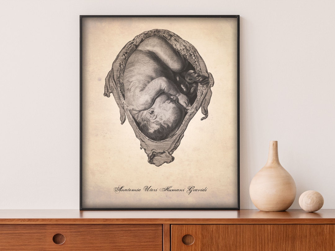Human Anatomy Print Female Body OBGYN Poster Gynecologist Uterus Art ...