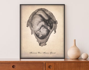 Human Anatomy Print - Female Body - OBGYN Poster - Gynecologist - Uterus Art Print - Fetus In Womb - Giclee or Canvas