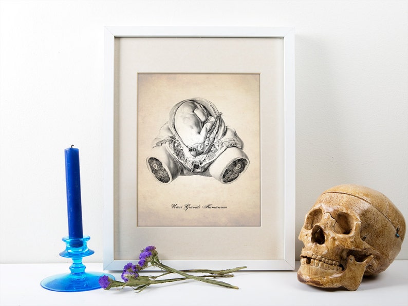 Uterus Art Print In Utero Poster Fetus in Womb Scientific Illustration Medical Drawing Giclee or Canvas image 2