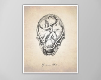 Human Anatomy Print - Twins In Utero Art Print - Medical Illustration - OBGYN Poster - Motherhood Gift - Anatomy Art