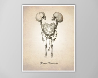 May include: A black and white anatomical illustration of conjoined twins, labeled "Gemini Coniunctus".