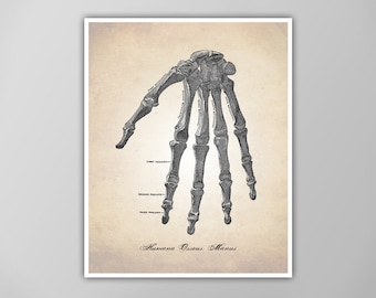 Human Anatomy Art Print - Skeleton Hand Diagram - Anatomy Poster - Medical Drawing - Giclee or Canvas!