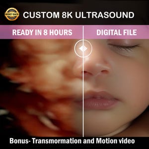 Turn Your Ultrasound into a Baby Picture. 3D, 4D, 5D and HD Ultrasound, Real View, ultrasound photo, unborn baby, ultrasound scan,8k image