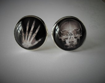 HAND & SKULL X-Ray Cufflinks / Gift for Radiologist / Gift for Him / Gift for Doctor / XRay / Cuff Links / Coworker Gift / Gift Boxed