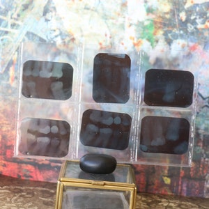 3 Vintage Teeth X-rays