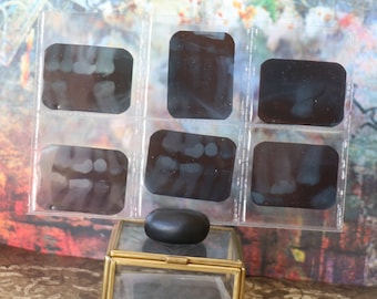 3 Vintage Teeth X-rays