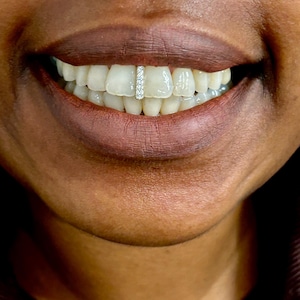 Può includere: Primo piano della bocca sorridente di una persona con un gioiello dentale di diamanti verticale. I denti sono bianchi e le labbra sono di una tonalità scura. Il gioiello è una fila di piccoli diamanti scintillanti.
