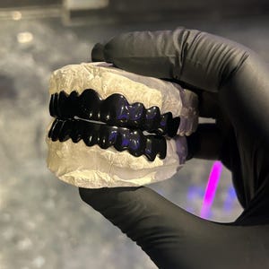 Può includere: Un calco dentale con un set di denti neri. I denti sono lucidi e sembrano fatti su misura. Il calco è tenuto da una mano guantata, suggerendo una procedura dentale o cosmetica.