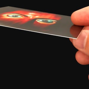 May include: A close-up of a person's eyes, with one eye looking directly at the camera. The eyes are surrounded by red skin, and the background is dark.