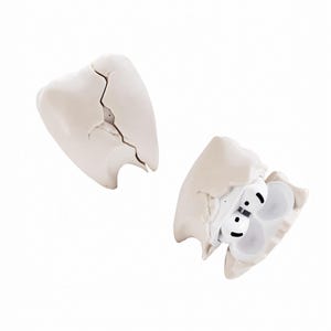 Puede incluir: Una funda en forma de diente roto, de color blanquecino, dividida en dos, que revela un par de auriculares inalámbricos blancos. La funda tiene un aspecto agrietado, lo que sugiere un elemento de diseño. Los auriculares son blancos con detalles en negro.