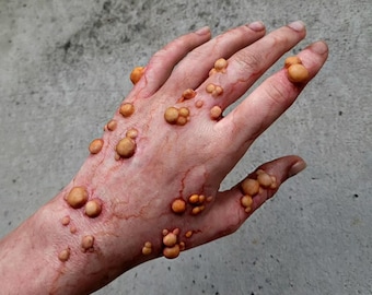 Silicone Boils Prosthetic: Special Effects Makeup