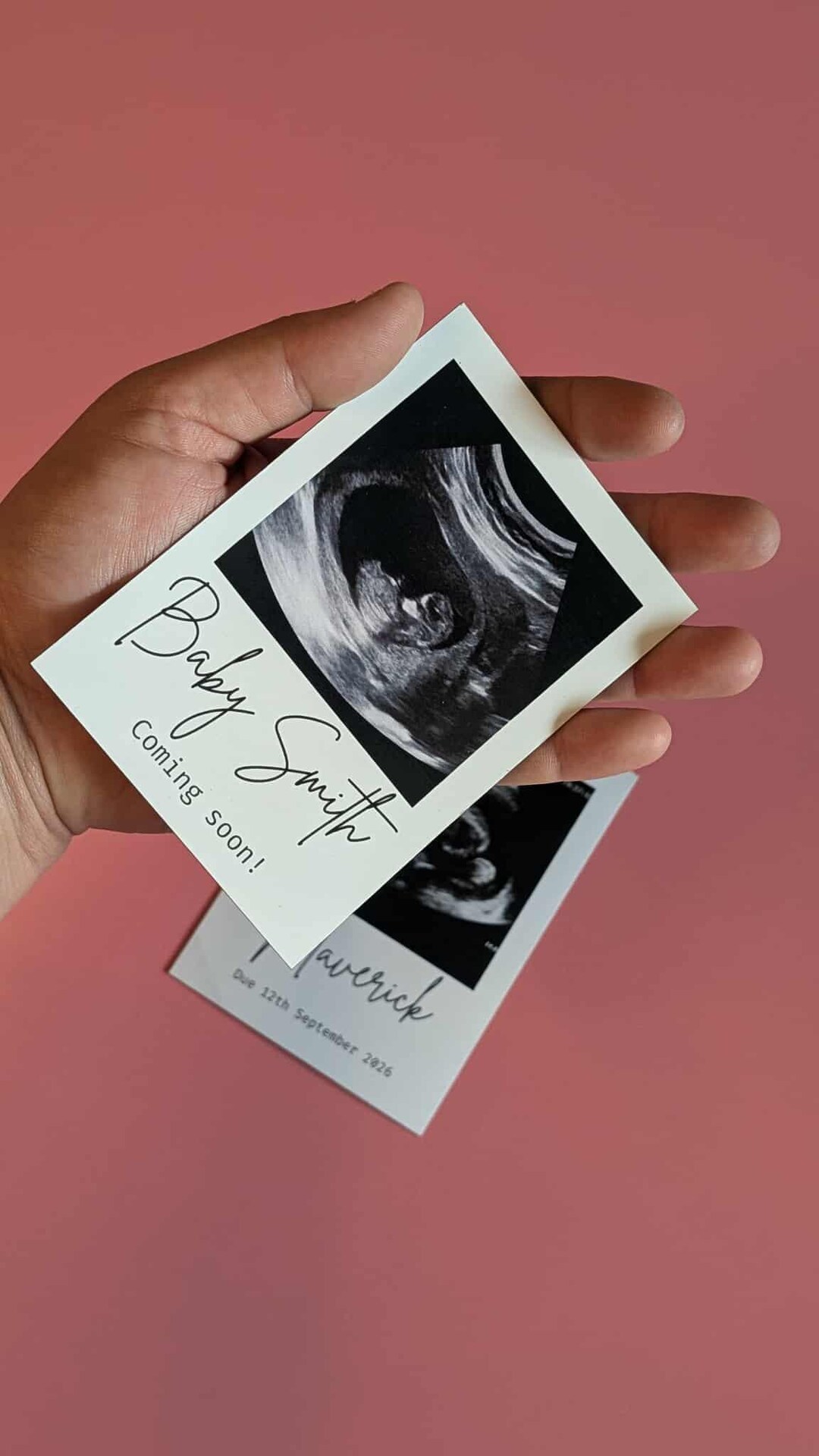 Sonogram Magnets Sonogram Baby Announcement Magnet Keepsake - Etsy