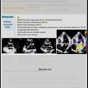 May include: Educational medical diagram about Mitral Regurgitation, detailing etiology, auscultative findings, and pathophysiology. Includes echocardiogram images and vocabulary terms. The text is in black and white.