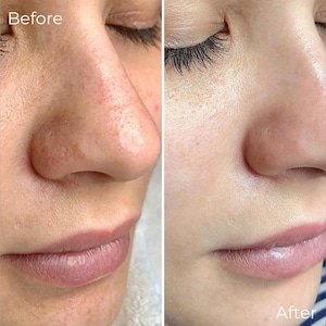 Siero con vitamina C, E e olio di avocado per il viso / Siero naturale / Mana Beauty Lab Skincare immagine 6