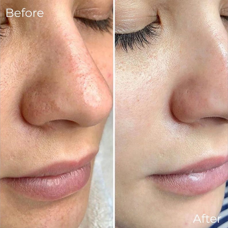 Siero con vitamina C, E e olio di avocado per il viso / Siero naturale / Mana Beauty Lab Skincare immagine 6