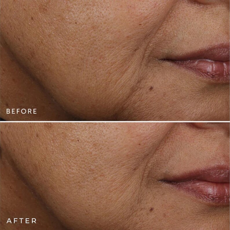 Natural Retinol Alternative Oil Serum: Bakuchiol & Rosehip Seed image 4