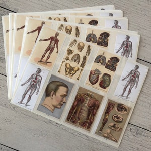 PHC nr. 147 antieke medische kaarten uit 1904, stickervelreproducties