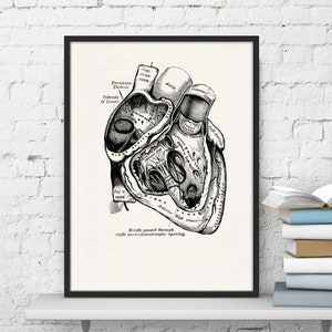 Wall art print, Human Anatomy Heart in black, Anatomical heart wall art, Doctor office gift, SKA039 image 5