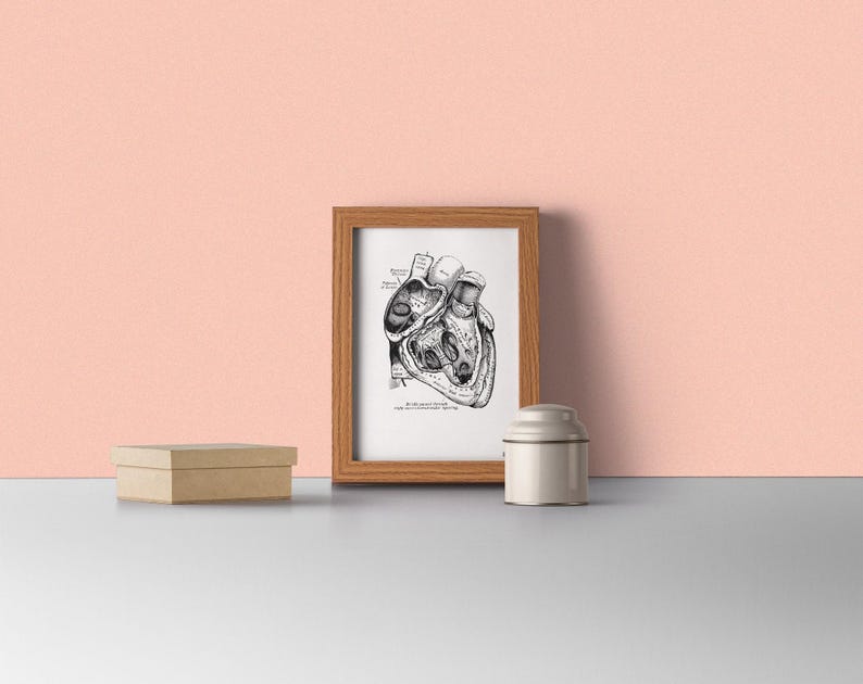 Wall art print, Human Anatomy Heart in black, Anatomical heart wall art, Doctor office gift, SKA039