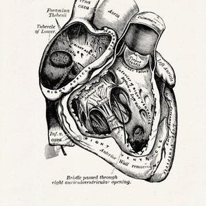 Wall art print, Human Anatomy Heart in black, Anatomical heart wall art, Doctor office gift, SKA039