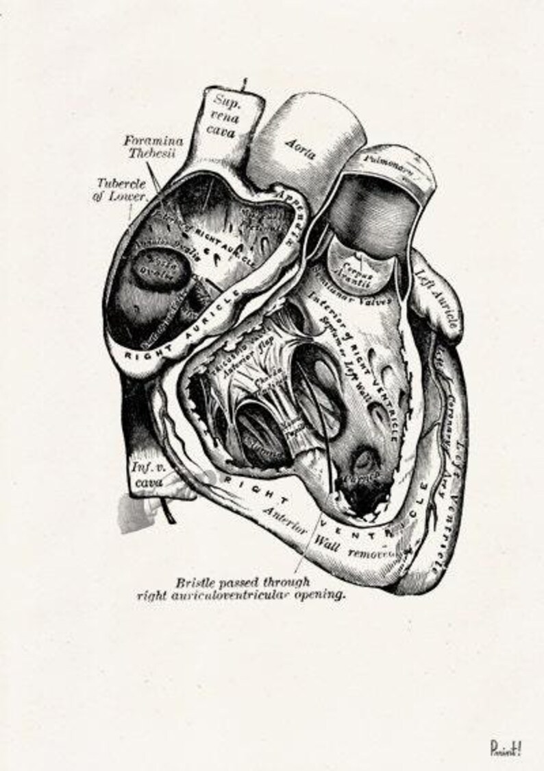 Wall art print, Human Anatomy Heart in black, Anatomical heart wall art, Doctor office gift, SKA039