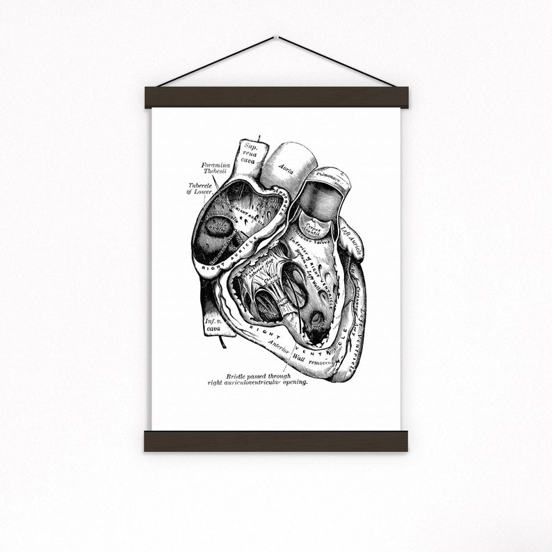Wall art print, Human Anatomy Heart in black, Anatomical heart wall art, Doctor office gift, SKA039 image 1