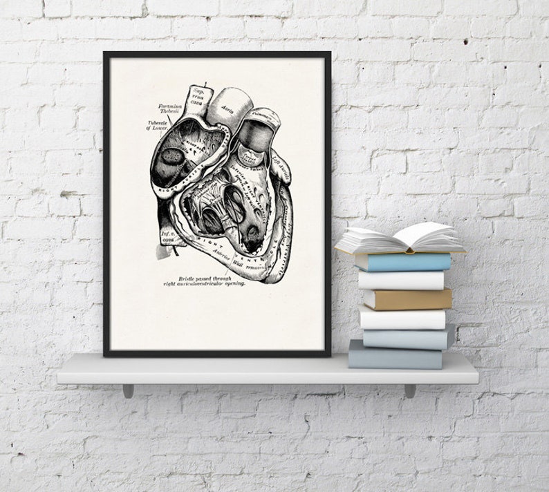 Wall art print, Human Anatomy Heart in black, Anatomical heart wall art, Doctor office gift, SKA039 image 5