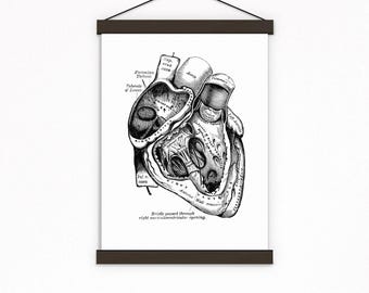 Valentinstag Wand KunstAnatomisches Herz Print: Schwarzes Herz Wand Kunst, Arzt Geschenk
