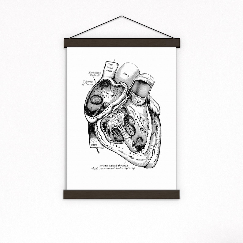 Wall art print, Human Anatomy Heart in black, Anatomical heart wall art, Doctor office gift, SKA039