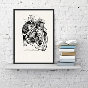 Wall art print, Human Anatomy Heart in black, Anatomical heart wall art, Doctor office gift, SKA039