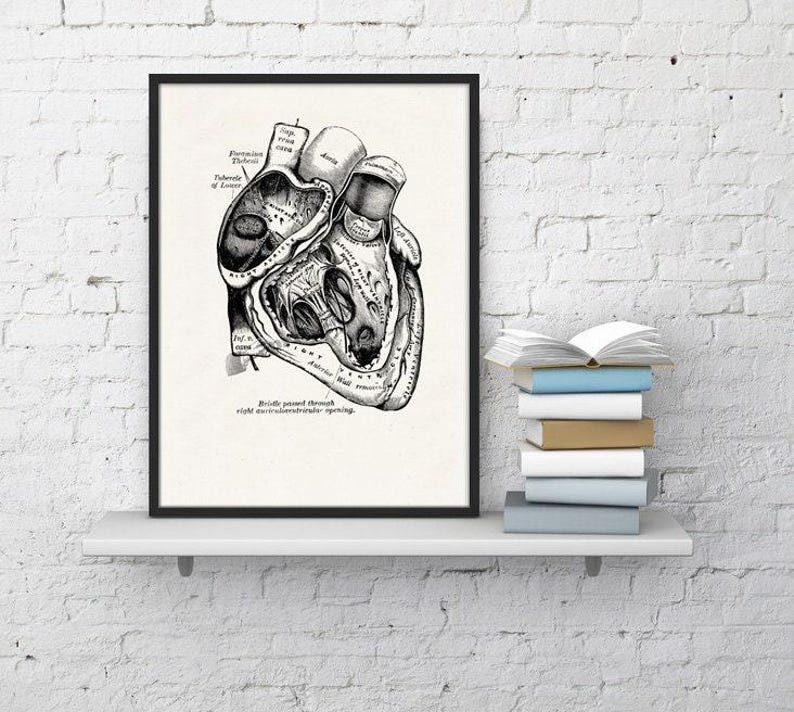 Wall art print, Human Anatomy Heart in black, Anatomical heart wall art, Doctor office gift, SKA039