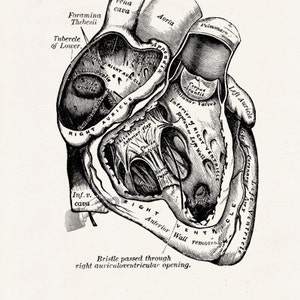 Wall art print, Human Anatomy Heart in black, Anatomical heart wall art, Doctor office gift, SKA039 image 6