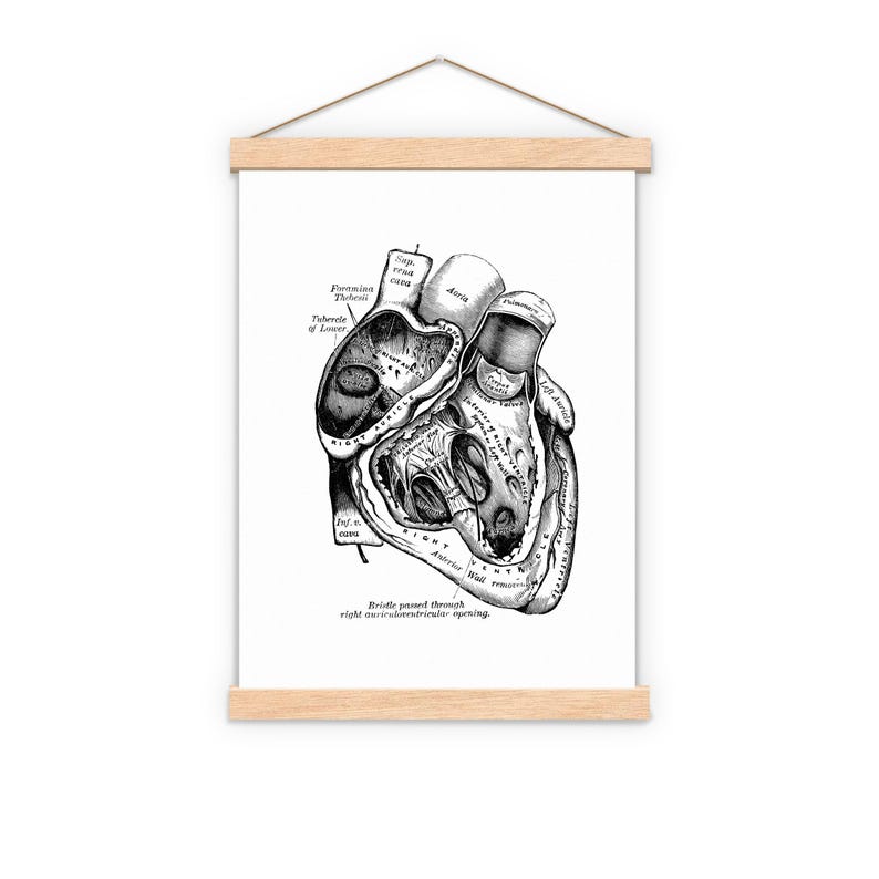 Wall art print, Human Anatomy Heart in black, Anatomical heart wall art, Doctor office gift, SKA039