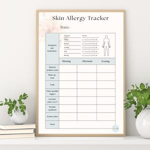 May include: A framed print labelled "Skin Allergy Tracker" with a light beige border. The tracker includes sections for symptoms, skincare products, and other triggers. The text is black on a white background with light blue accents.