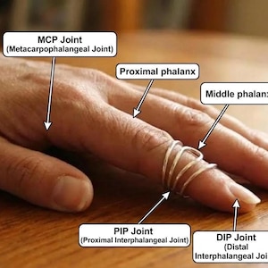Könnte beinhalten: Anatomiediagramm einer Hand mit Beschriftungen, die auf die MCP-, PIP- und DIP-Gelenke sowie die proximalen und mittleren Phalangen zeigen. Ein silberner Ring ist um den Finger gewickelt. Das Bild befindet sich auf einer Holzoberfläche.